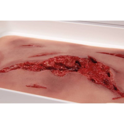 Erler Zimmer Wound Moulage Large Laceration Wounds with Bleeding Function